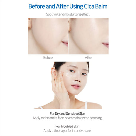 [ETUDE] SoonJung 10-Panthensoside Cica Balsam